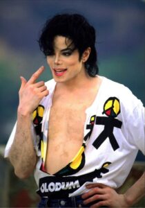 Did Michael Jackson have vitiligo?