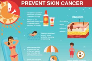 Unveiling Skin Cancer Prevention Strategies